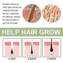 OUHOE Herbal Hair Loss Oil Firms Hair, Prevents Hair Loss, Strengthens Hair, Cleans Scalp, Repairs Smoothness, Hair L