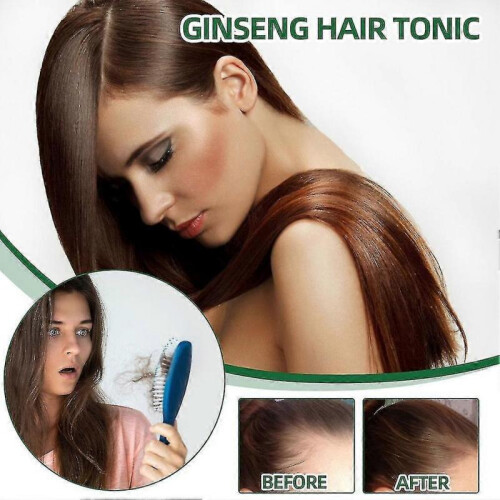 Ouhoe Ginseng Hair Tonic 100ml 1