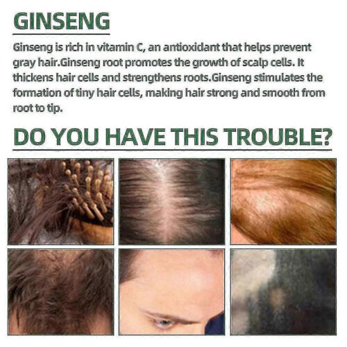 Ouhoe Hair Growth Oil 2