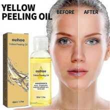 Ouhoe Bright White Exfoliating Oil Deep Cleansing Exfoliating Dead Skin Care Whiten Serum 3556107457829