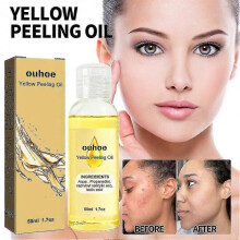 2pcs Ouhoe Bright White Exfoliating Oil Deep Cleansing Exfoliating Dead Ski 4079309383219