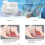 PC+EVA Adjustable Braces to Alleviate Grinding and Improve Sleep Tools 5