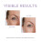 OOTD, Overnight Eye Cream, 0,88 oz (25 g) 3