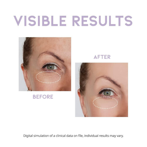 OOTD, Overnight Eye Cream, 0,88 oz (25 g) 2