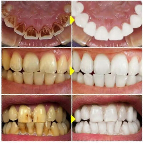 (2pcs) 3pcs SP-6 Probiotic Whitening Toothpaste 2