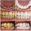 (3pcs) 3pcs SP-6 Probiotic Whitening Toothpaste 3