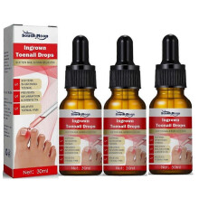 3pcs Ingrown Toenail Treatment Serum Nail Correction Recover Oil Pain Reliever Nail