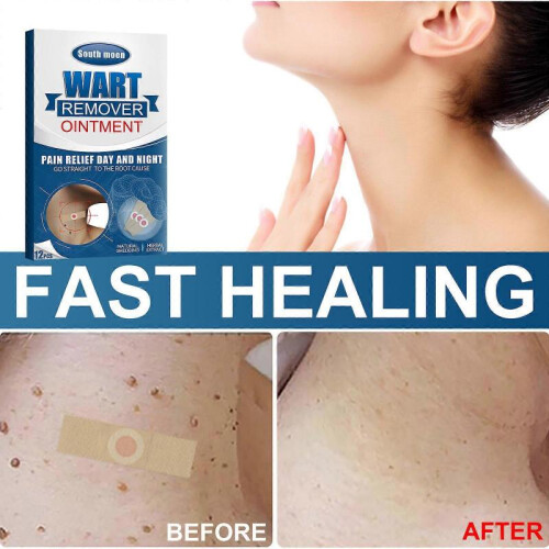 (1pc) wart-killing patch, flat and excellent corns, thorns, warts, easy-pinging, plantar, nevus patch, repair patch 1