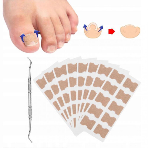 Set for Ingrown Toenails