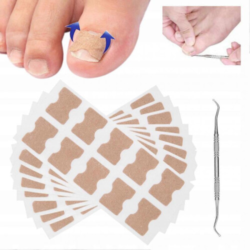 Set for Ingrown Toenails 1