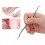 Set for Ingrown Toenails 5