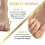Buckle for Ingrown Nails 3