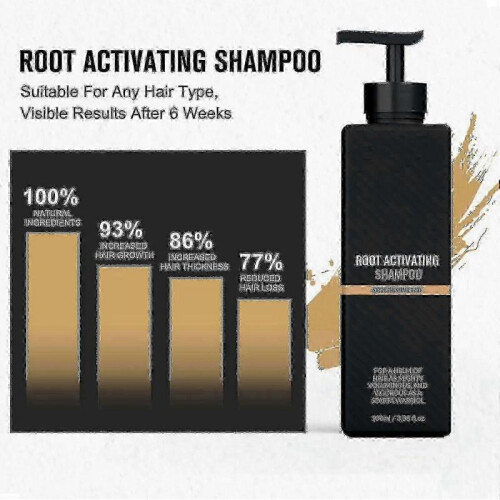 (3pcs) Root Shampoo, Root Shampoo, Root Promotes For Men - Youa 2