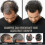 (1pcs) Root Shampoo, Root Shampoo, Root Promotes For Men - Youa 5