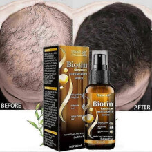 Biotin Hair Growth Spray Anti Hair Loss Fast Regrowth Scalp Treatment Serum