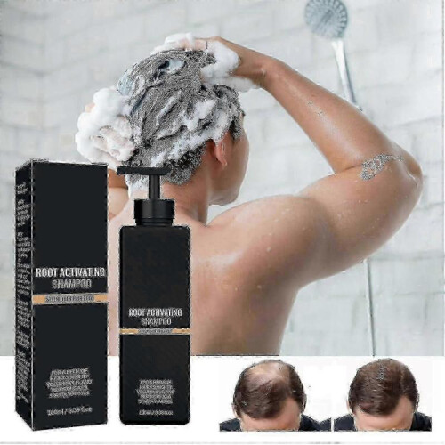 (1pcs) Root Shampoo, Root Shampoo, Root Promotes For Men - Youa 1