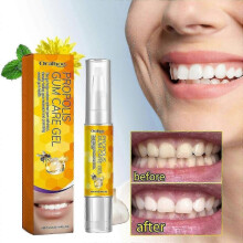 Propolis Gum Care Gel, Propolis Oral Gum Repair Gel, Propolis Teeth Regrowth Dental Gel, Gum Instant Soothing Gel
