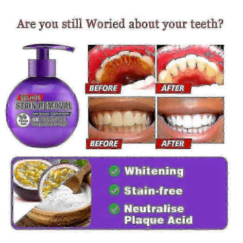 (Purple) Baking Soda Toothpaste Stain Removal Teeth Cleaning Brightening Pump Toothpaste Cleaning Teeth 2