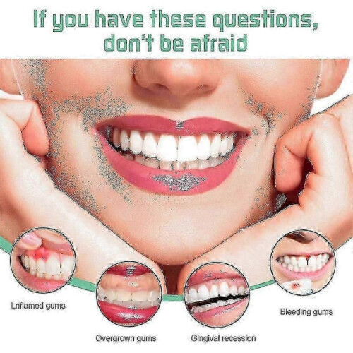 2pcs Gum Drops Clean Teeth Remove Teeth Macular Relieve Mouth 2