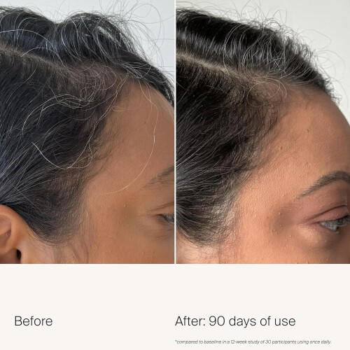 Living Proof Living Proof Scalp Care Dichteserum 2