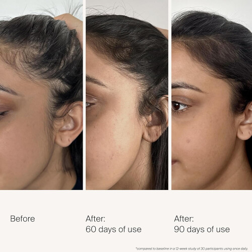 Living Proof Living Proof Scalp Care Dichteserum 1
