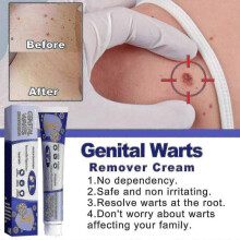 South Moon Wart Cream Repairs and Cleanses Skin Normal Wart Cream Body Face Wart Cream BF  | 7351446467500