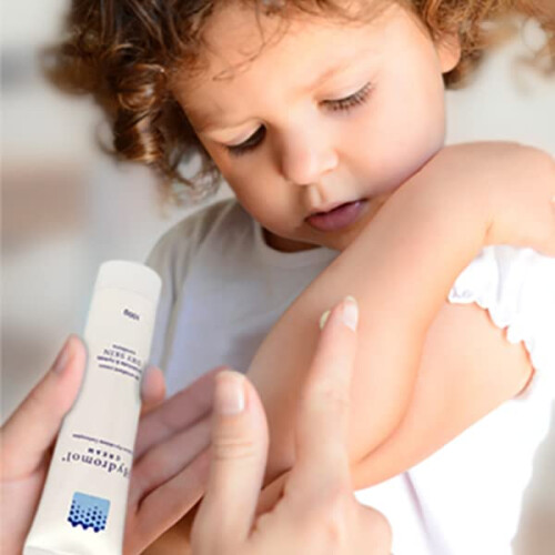Hydromol Ointment 100g, Eczema & Dry Skin 1