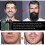 Beard Growth Kit, Beard Roller for Men, Beard Grooming Tools for Beard Rapid Growth And Thickening 5