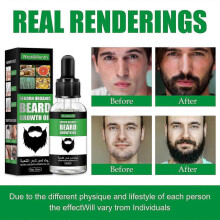 (5pcs) West&Month Beard Growth Care Oil Men's Beard Oil Gentle Care Beard Moisturizing Care Beard Oil