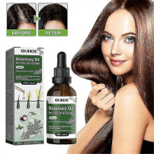 (2pcs) 1-3pcs Rosemary Oil For Hair And Scalp-hair Oil For Hair Loss To Stimulate Hair Growth With Castor Oil 50 Ml - dd
