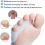 Toe Spreader Small Toe, 4pcs Silicone Toe Spacer for Overlapping Toes 3