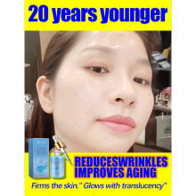 (1 Bottle) wrinkle free,20 years younger