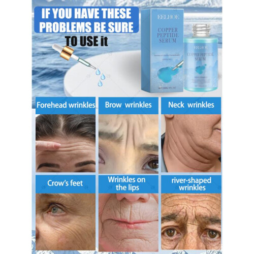 (1 Bottle) wrinkle free,20 years younger 2
