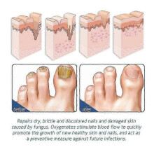 3pcs Foot And Nail Spary, Natural And Powerful Foot Care