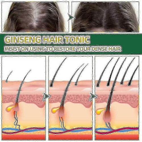 3pcs Ouhoe Ginseng Hair Tonic 100ml | |~A 2
