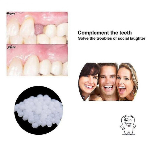 100g Resin False Teeth Solid Glue Temporary Tooth Repair Set Teeth And Gap False Teeth Solid Glue Denture Adhesive Dentist 1