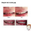 100g Resin False Teeth Solid Glue Temporary Tooth Repair Set Teeth And Gap False Teeth Solid Glue Denture Adhesive Dentist 3