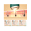 Laser-Haarentfernung, IPL Permanent (Grün) 2