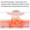 Neck Massager, Electromagnetic Pulse Neck Massager with Heating Function, 3d Fitting Technology 5