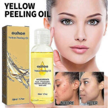 NEW Ouhoe Bright White Exfoliating Oil Deep Cleansing Exfoliating Dead Ski 3305101832930