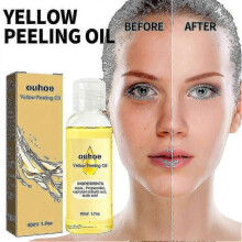 Ouhoe Bright White Exfoliating Oil Deep Cleansing Exfoliating Dead Skin Care Whiten Serum 3556107457829
