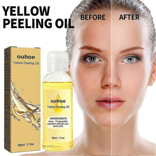 (2pcs)1-3pcs Ouhoe Bright White Exfoliating Oil Deep Cleansing Exfoliating Dead Ski 1