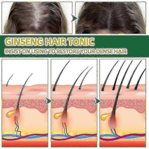 3pcs Ouhoe Ginseng Hair Tonic 100ml | | 2