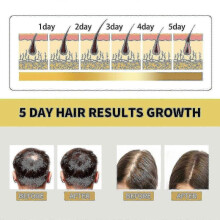 OUHOE ginger anti-itching dense hair shampoo hair growth Moisturizing Solid hair dense hair fluffy conditionin~A