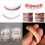 Braces Adult Portable Conceal Missing Teeth And Cavities Between Teethdenture 7
