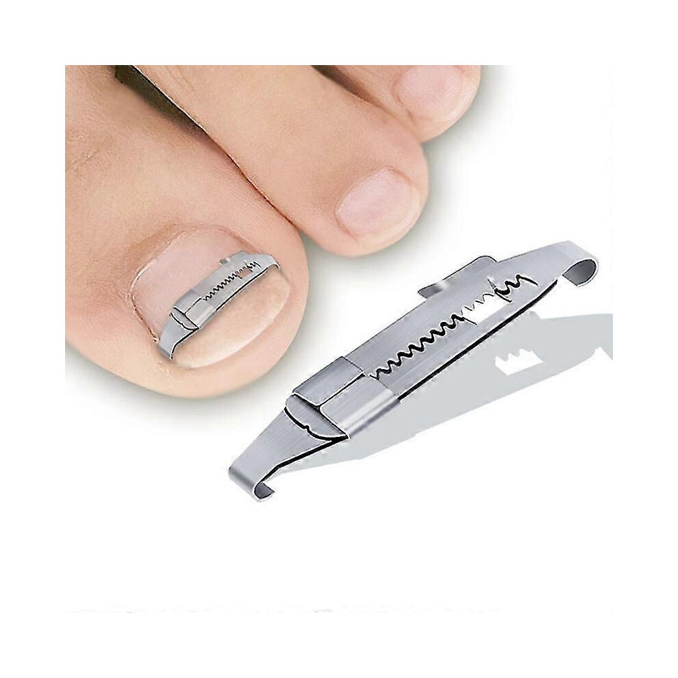 Kikidex (As Show, One Size) Pedicure Recover Embed Toe Nail Ingrown Toenail Corrector Treatment Foot Tools