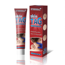 Wart Cream Wart Removal Cream Corn Cream Wart Wart Skin Care