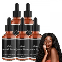 Hair Growth Serum with African Olives - Anti Hair Loss Oil for Women, Nourishes & Strengthens Dry, Damaged Hair, Works for All Hair Types - 5PCS Set