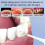 (Basic version, white) Teeth Cleaner, Sonoshine Teeth Cleaner, Sonosparkle Teeth Cleaner 4