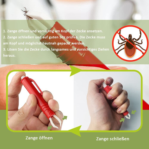Pinzette per zecche per cani, gatti e bambini, set da 3, ganci per zecche e set da 2 1